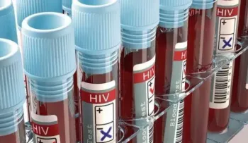 Una vacuna experimental contra el VIH resulta prometedora en animales