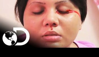 El caso de la adolescente que llora sangre
