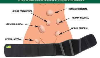 Hernia umbilical; remedios caseros 