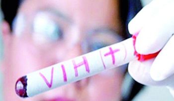 Crean en Rusia una vacuna única contra el VIH