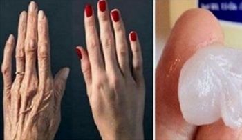 Las manos lucían de 70 años, y su amiga le dio una receta secreta, que luego no podía creer como se pusieron¡