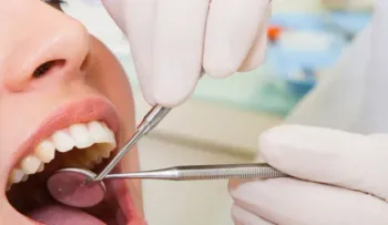 Mala higiene oral provoca periodontitis