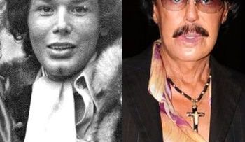 Algunos famosos que perdieron su belleza a causa de la cirugía plastica
