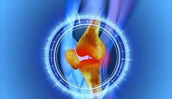 ¿Te duele la rodilla? Causas y remedios