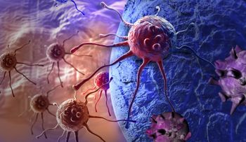 Anota la clave para vencer al cáncer de colon