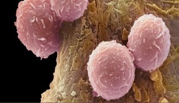 Descubren por qué fallan ltratamientos contra el cáncer