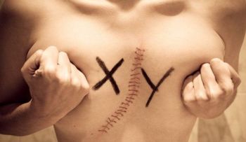 ¿Sabes qué es la intersexualidad? 1.7% de la población humana es diferente
