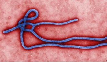 El ébola, un virus que puede viajar alrededor del mundo