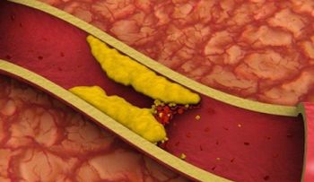 8 infusiones para reducir el colesterol