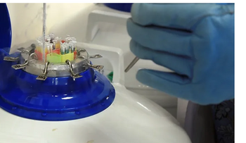 Donante con gen cancerígeno engendró 200 hijos