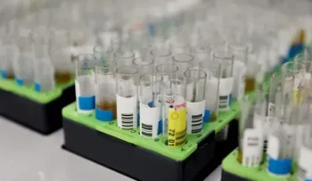 Farmacéutica pide aprobar un prometedor medicamento contra alzhéimer