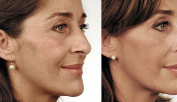No deje que su cuello delate su edad, 6 trucos de belleza para las arrugas