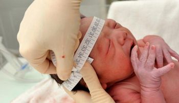 Nace primer bebé en NY con microcefalia asociado al Zika 