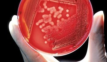 Nueva combinación para la gonorrea resistente al tratamiento