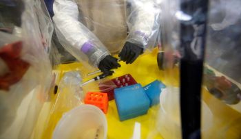 Dos muertos en Uganda por fiebre de Marburgo, virus similar al ébola 