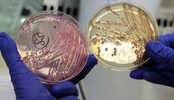 Revelan cómo las bacterias se protegen al atacar a otros microorganismos