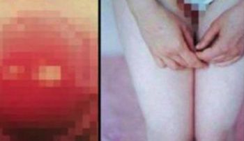 Si tu pareja tiene algunos de estos síntomas llega rápido al hospital! Podría ser muy fatal!