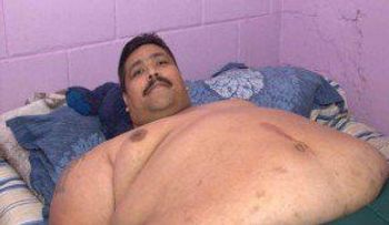 El hombre más obeso del mundo comienza a adelgazar tras exitosa operación