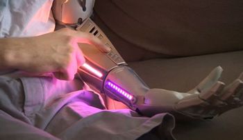 De película: Perdió su brazo y ahora tiene uno biónico con láser, puerto USB y un dron