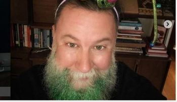 No puede ser; arboles de Navidad en la cabeza y en la barba