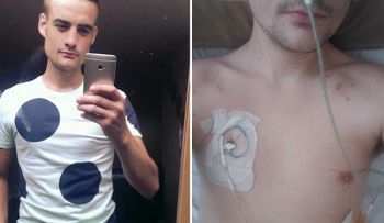 Un joven con rara enfermedad no puede ir al baño 