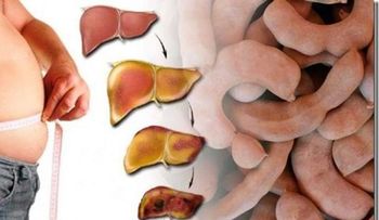 Es increíble como esta fruta hace desaparecer el hí­gado graso 