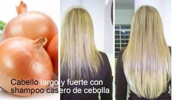 Cómo haber champú de cebolla, para que el pelo crezca de forma rápida y saludable