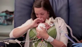 Video: ¡Extraño! Bebé con envejecimiento prematuro