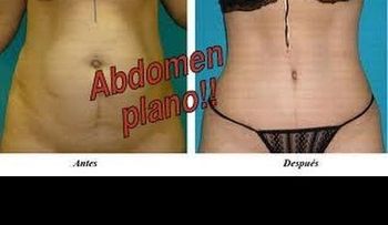 Video: Elimina líquidos para tener vientre plano 