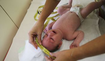 Niños del zika: bebés con desórdenes causados por el virus