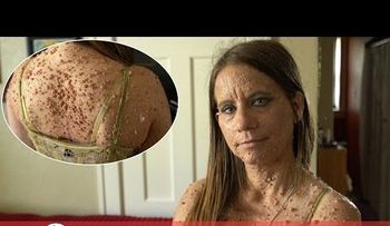 Los hombres sienten miedo de acercarse a ella. Pero a los 16 años nunca hubiera imaginado esta pesadilla