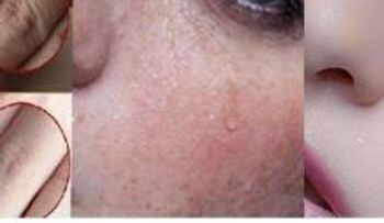  Colócate esta mascarilla en la noche y despierta como un príncipe o una princesa 