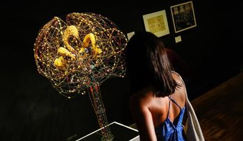 Avance científico: desarrollan mapa de biomarcadores para detectar enfermedades neurodegenerativas