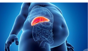 Microbiota influye en gravedad del hígado graso