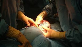 Los niños de un año altos y con mucho peso podrían estar en riesgo de obesidad posterior