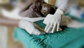 Dispositivo israelí permite circuncidar a 700.000 ruandeses y prevenir el SIDA.
