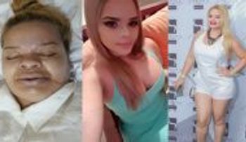 Una joven pierde la vida en una intervención quirúrgica y lo que dice el tío es ESCALOFRIANTE