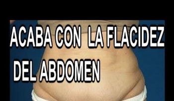 Piel colgada luego de perder 160 libras (Video)