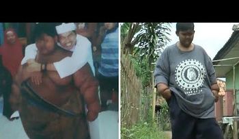 "Solo comía y dormía": La dramática transformación del niño más obeso del mundo 