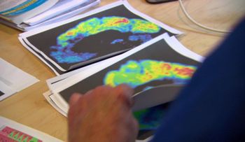Cómo afrontar el Alzheimer, epidemia del siglo XXI