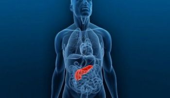 Tratar el cáncer de páncreas con electrodos