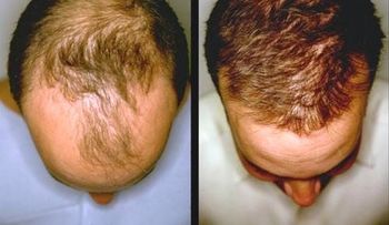 Con estos dos simples pasos puede hacer crecer el cabello naturalmente
