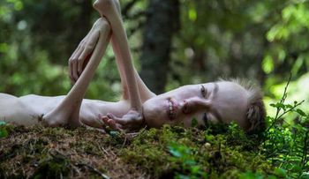 Le decían "el jorobado de Notre Dame" por una enfermedad degenerativa, pero se desnudó para dar un mensaje