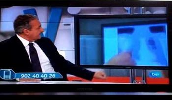 ¿Qué es la legionela?
