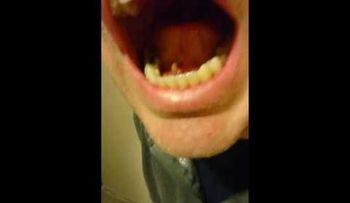 VIDEO FUERTE: Un hombre descubre algo debajo de su lengua 
