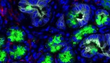 Investigadores de Clínica Mayo identifican primeros pasos en formación del cáncer de páncreas