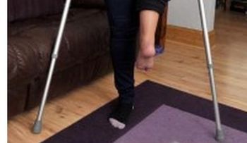 Pie izquierdo de una mujer reemplaza su rodilla