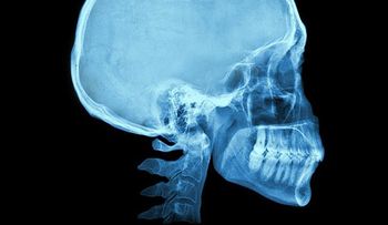 El extraordinario genio matemático que nació sin cerebro