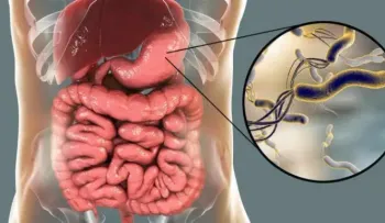 Estudio revela la gran resistencia de la Helicobacter pylori a los antibióticos