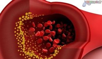 Estudios dan esperanza sobre medicamentos para colesterol